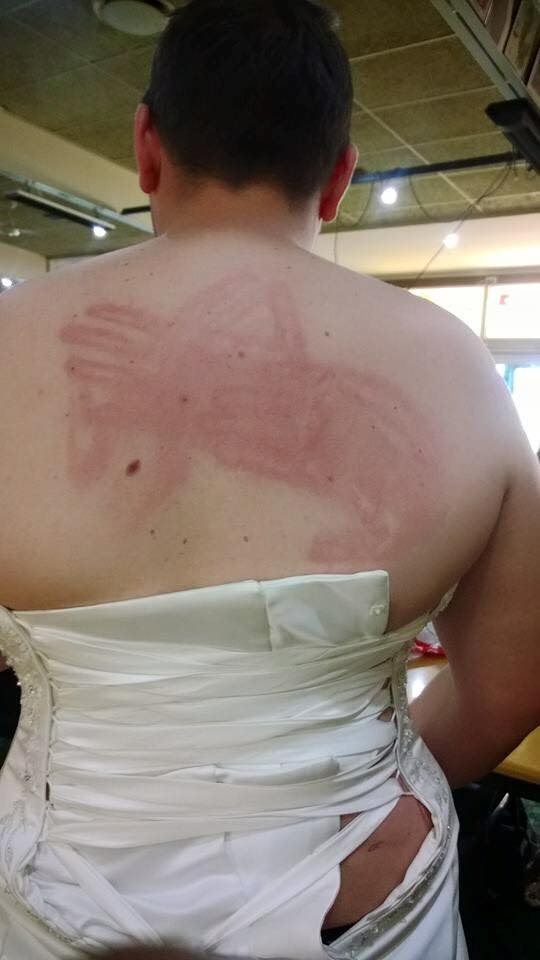 back slap.jpg