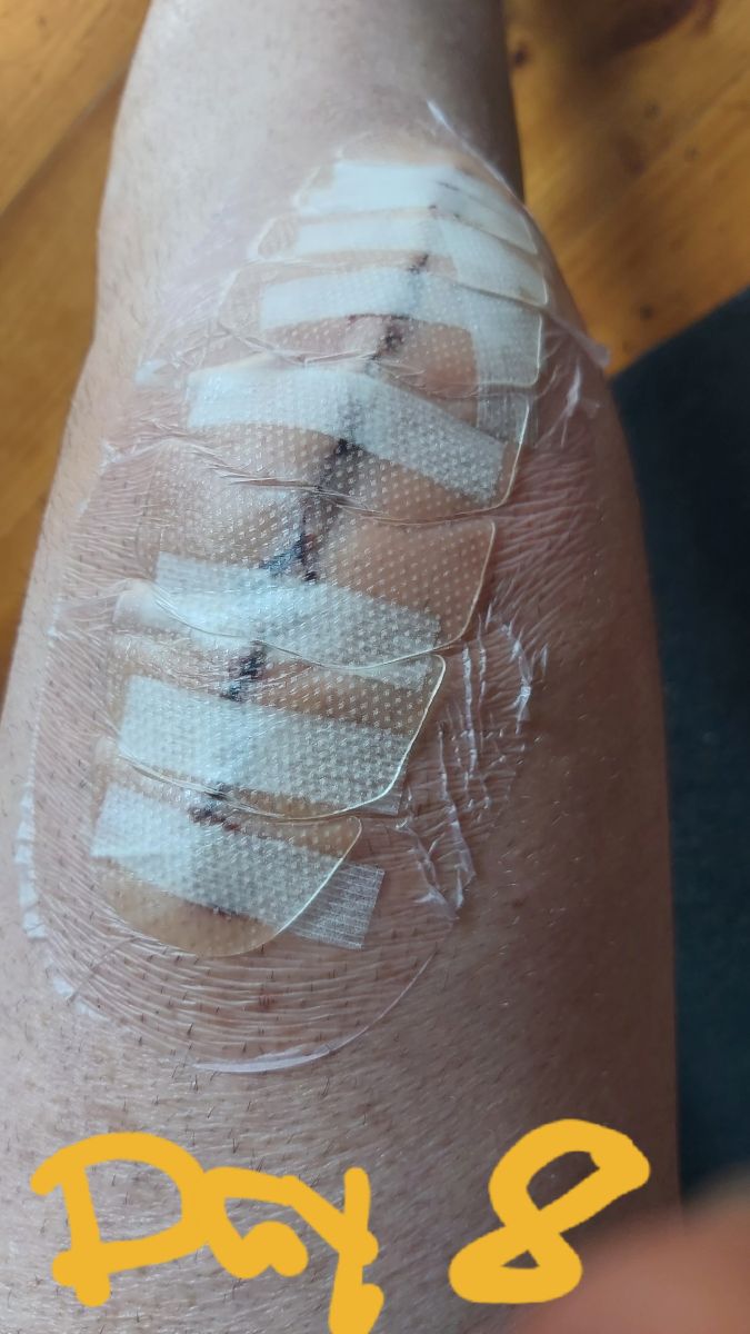 knee day 8 resized.jpg