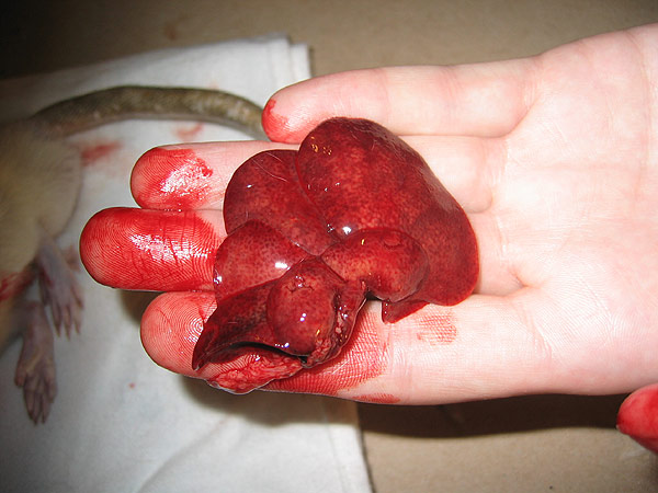 liver.jpg
