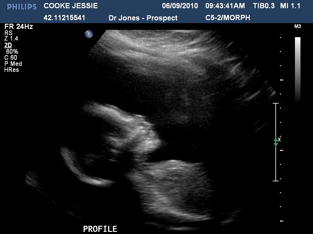 Bubs Profile.jpg