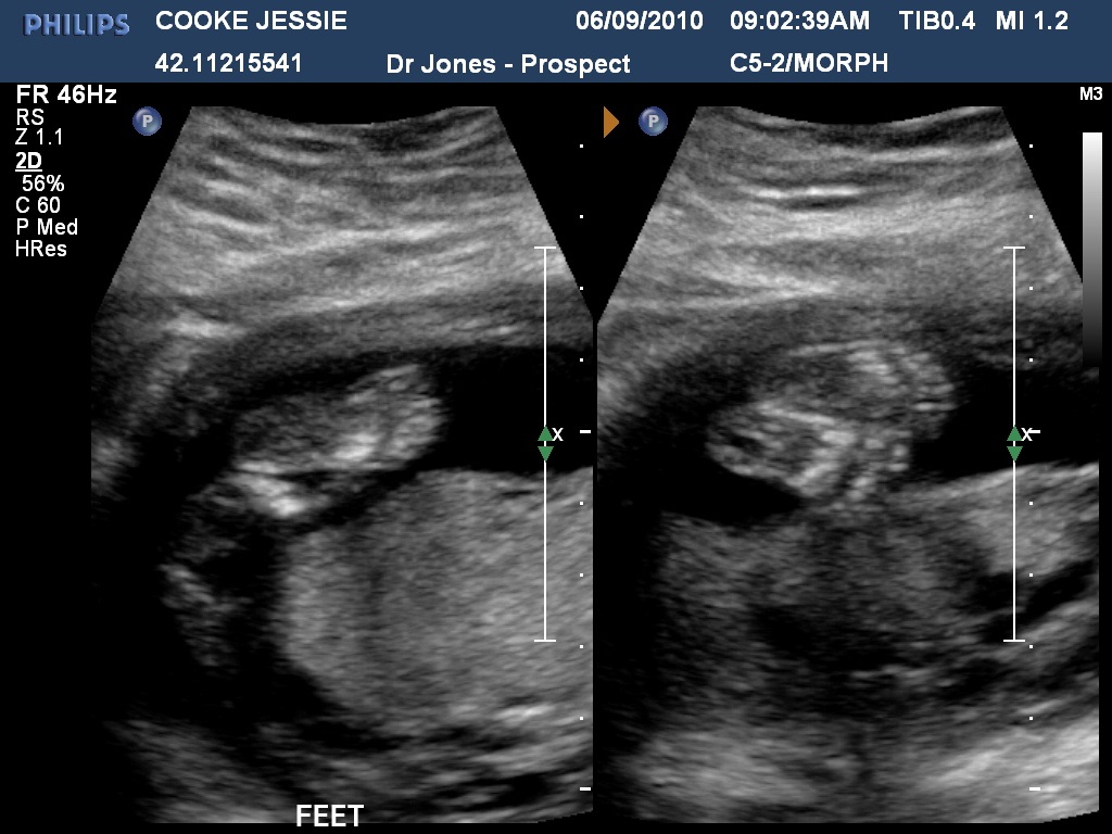 Bubs Feet.jpg