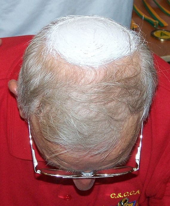 Tiges Pope Hat - Day 5.jpg
