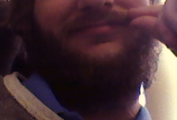 Injury beard.PNG